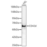 Western Blot - Anti-CD42d Antibody (A329219) - Antibodies.com