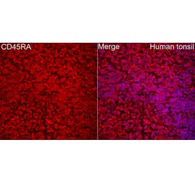 Immunofluorescence - Anti-CD45 Antibody (A329220) - Antibodies.com