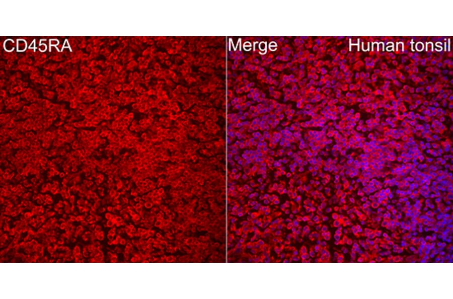 Immunofluorescence - Anti-CD45 Antibody (A329220) - Antibodies.com
