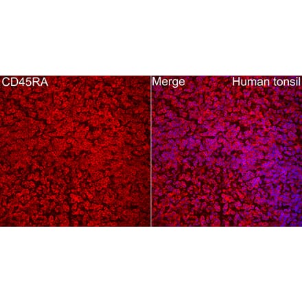 Immunofluorescence - Anti-CD45 Antibody (A329220) - Antibodies.com