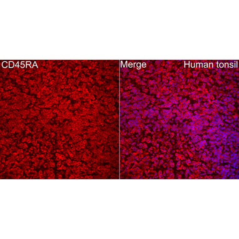 Immunofluorescence - Anti-CD45 Antibody (A329220) - Antibodies.com