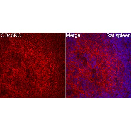 Immunofluorescence - Anti-CD45 Antibody (A329221) - Antibodies.com