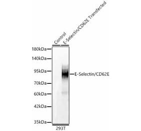 Western Blot - Anti-CD62E Antibody (A329225) - Antibodies.com