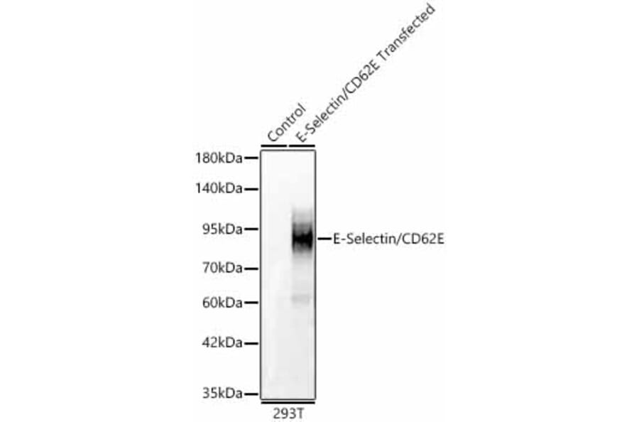 Western Blot - Anti-CD62E Antibody (A329225) - Antibodies.com
