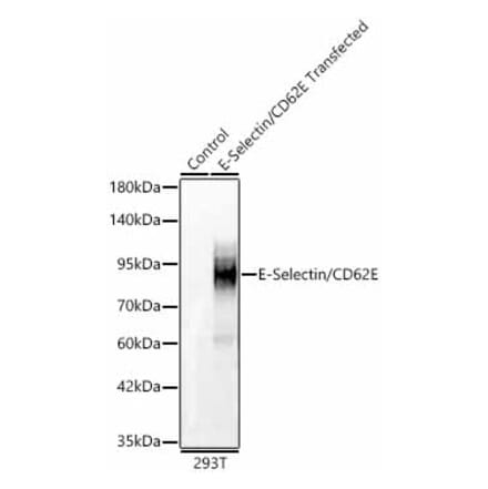 Western Blot - Anti-CD62E Antibody (A329225) - Antibodies.com