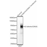 Western Blot - Anti-CD62E Antibody (A329225) - Antibodies.com