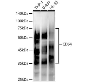 Western Blot - Anti-CD64 Antibody [ARC53678] (A329229) - Antibodies.com