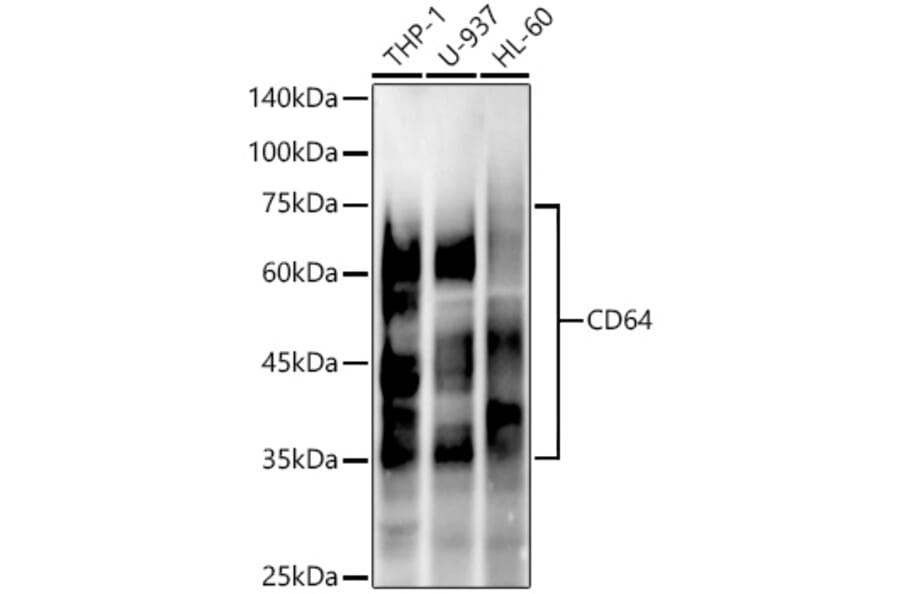 Western Blot - Anti-CD64 Antibody [ARC53678] (A329229) - Antibodies.com