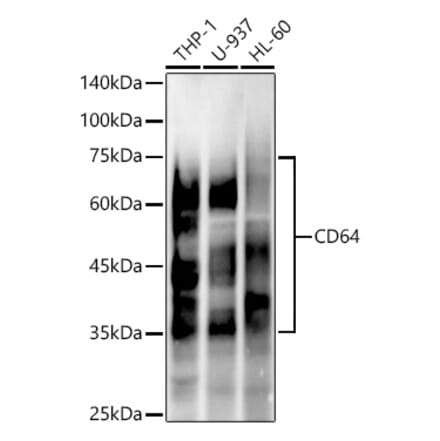 Western Blot - Anti-CD64 Antibody [ARC53678] (A329229) - Antibodies.com