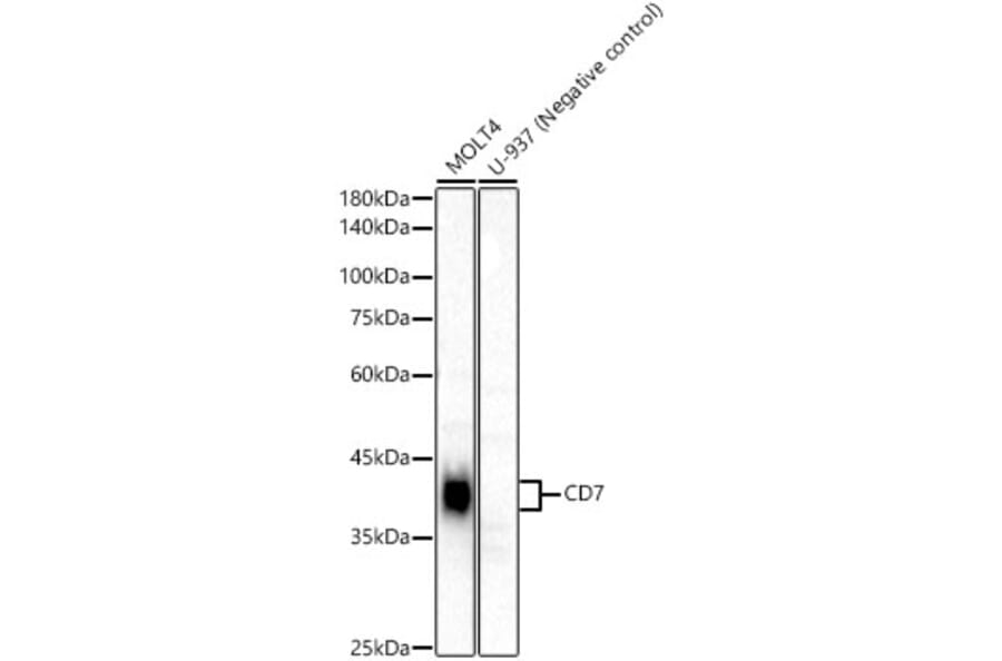 Western Blot - Anti-CD7 Antibody [ARC54671] (A329232) - Antibodies.com