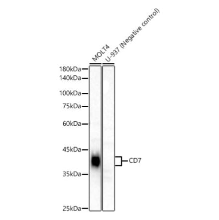 Western Blot - Anti-CD7 Antibody [ARC54671] (A329232) - Antibodies.com