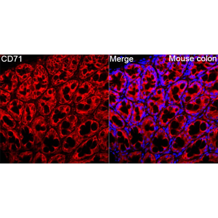 Immunofluorescence - Anti-CD71 Antibody (A329233) - Antibodies.com
