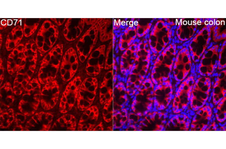 Immunofluorescence - Anti-CD71 Antibody (A329233) - Antibodies.com
