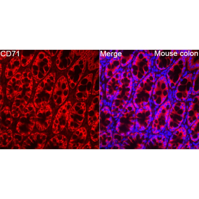Immunofluorescence - Anti-CD71 Antibody (A329233) - Antibodies.com