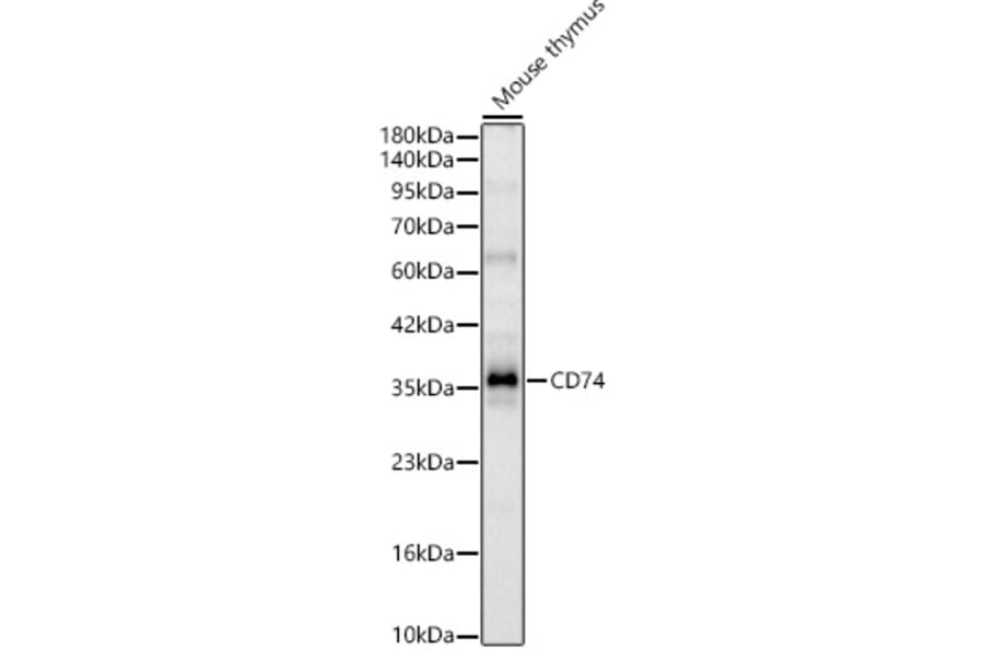 Western Blot - Anti-CD74 Antibody (A329234) - Antibodies.com
