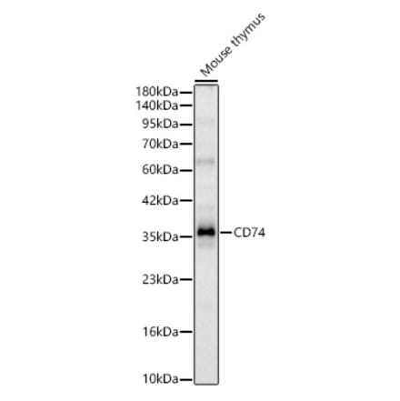 Western Blot - Anti-CD74 Antibody (A329234) - Antibodies.com