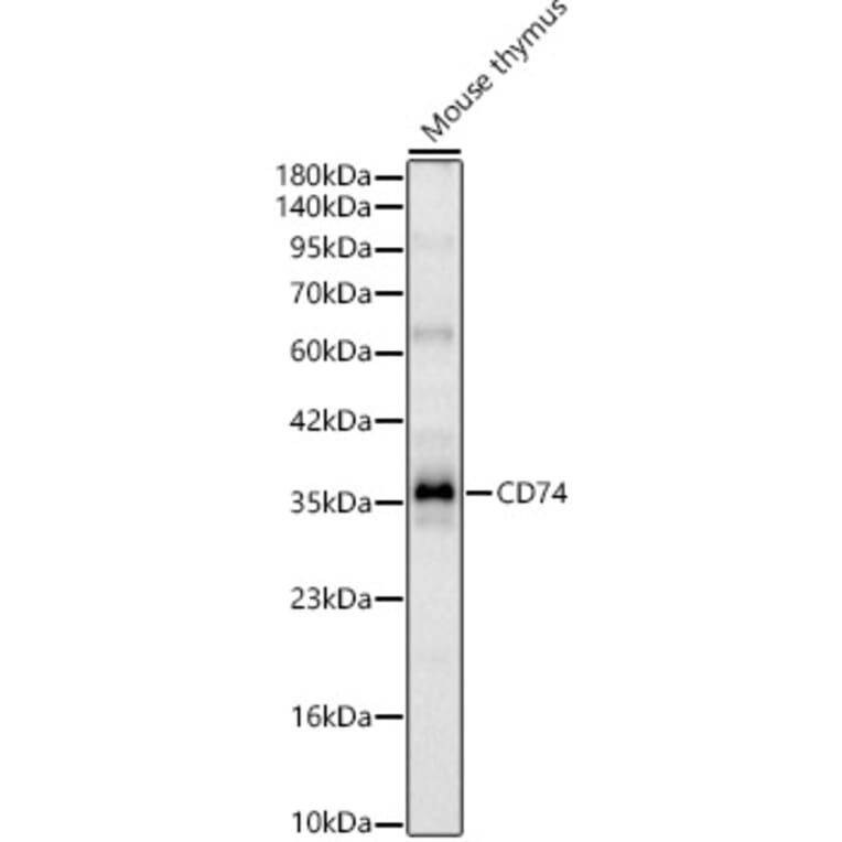 Western Blot - Anti-CD74 Antibody (A329234) - Antibodies.com