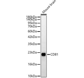Western Blot - Anti-CD81 Antibody (A329239) - Antibodies.com
