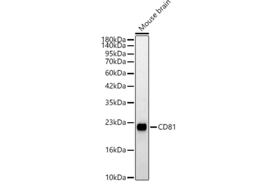 Western Blot - Anti-CD81 Antibody (A329239) - Antibodies.com