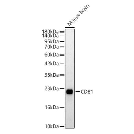 Western Blot - Anti-CD81 Antibody (A329239) - Antibodies.com
