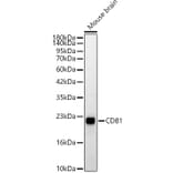 Western Blot - Anti-CD81 Antibody (A329239) - Antibodies.com