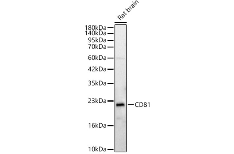 Western Blot - Anti-CD81 Antibody (A329239) - Antibodies.com