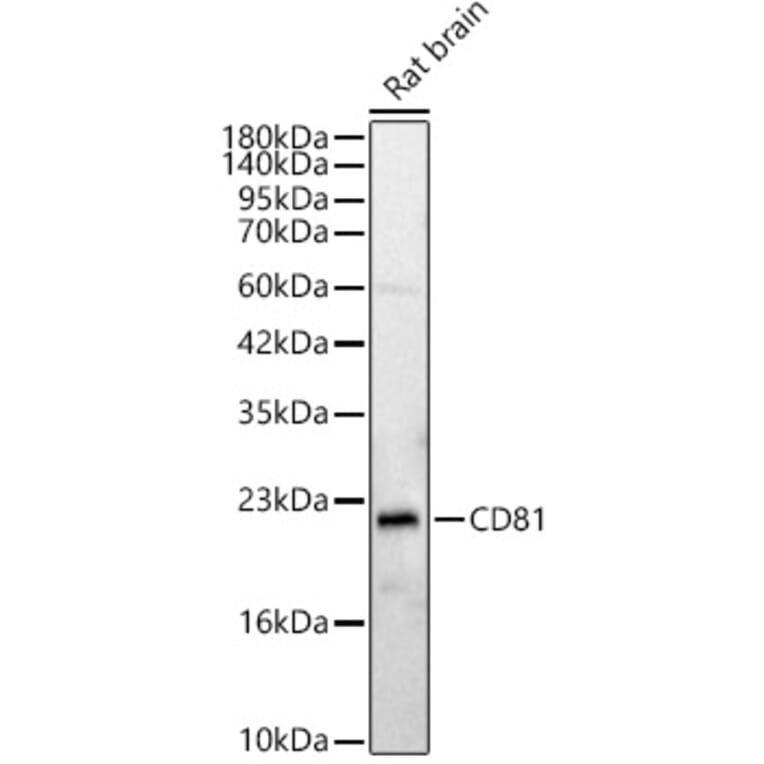 Western Blot - Anti-CD81 Antibody (A329239) - Antibodies.com