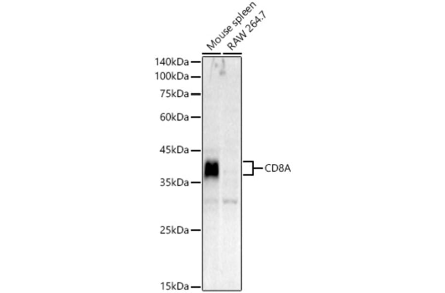 Western Blot - Anti-CD8A Antibody (A329240) - Antibodies.com