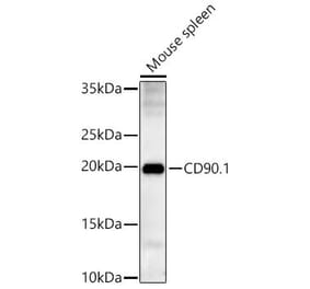Western Blot - Anti-Thy1 Antibody (A329241) - Antibodies.com