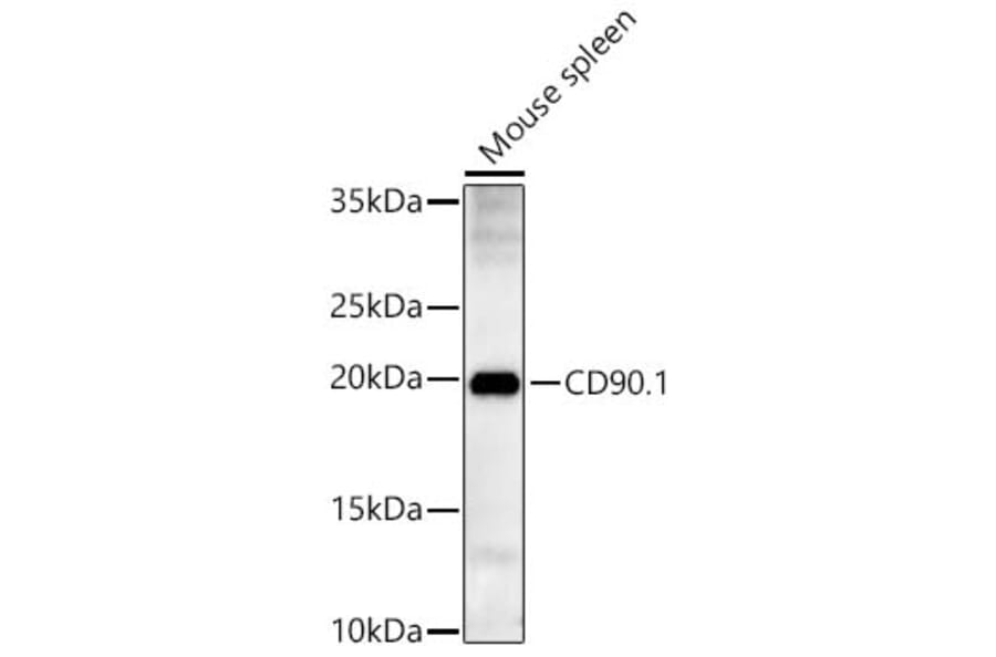 Western Blot - Anti-Thy1 Antibody (A329241) - Antibodies.com