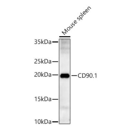 Western Blot - Anti-Thy1 Antibody (A329241) - Antibodies.com