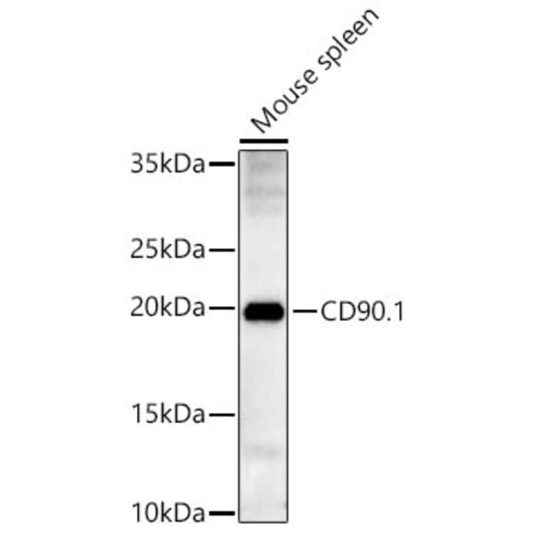 Western Blot - Anti-Thy1 Antibody (A329241) - Antibodies.com