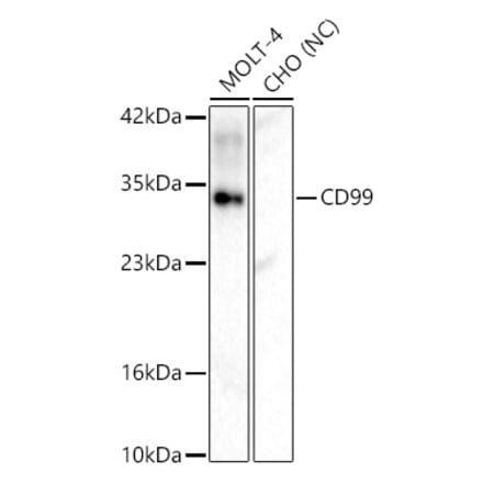 Western Blot - Anti-CD99 Antibody (A329244) - Antibodies.com
