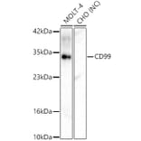 Western Blot - Anti-CD99 Antibody (A329244) - Antibodies.com