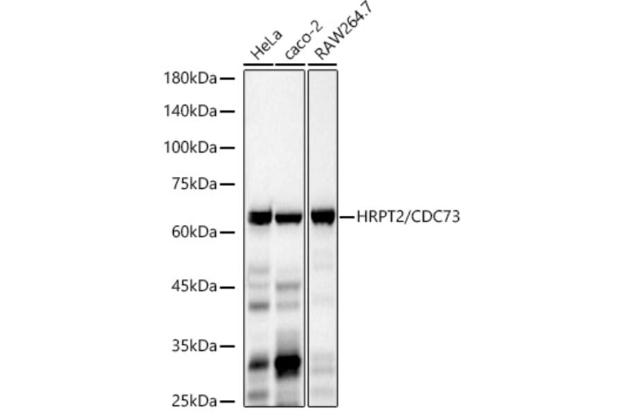 Western Blot - Anti-CDC73 Antibody [ARC3131] (A329245) - Antibodies.com