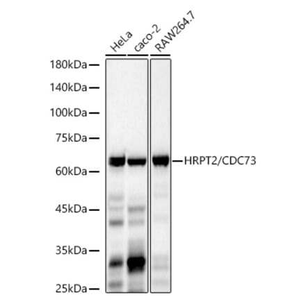 Western Blot - Anti-CDC73 Antibody [ARC3131] (A329245) - Antibodies.com