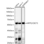 Western Blot - Anti-CDC73 Antibody [ARC3131] (A329245) - Antibodies.com