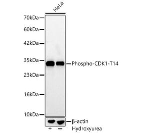 Western Blot - Anti-CDK1 (Phospho T14) Antibody [ARC66339] (A329246) - Antibodies.com