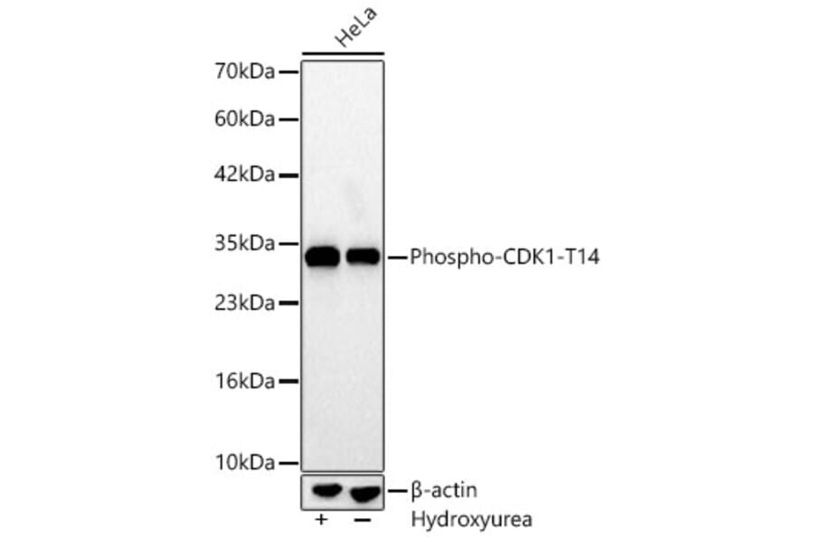 Western Blot - Anti-CDK1 (Phospho T14) Antibody [ARC66339] (A329246) - Antibodies.com