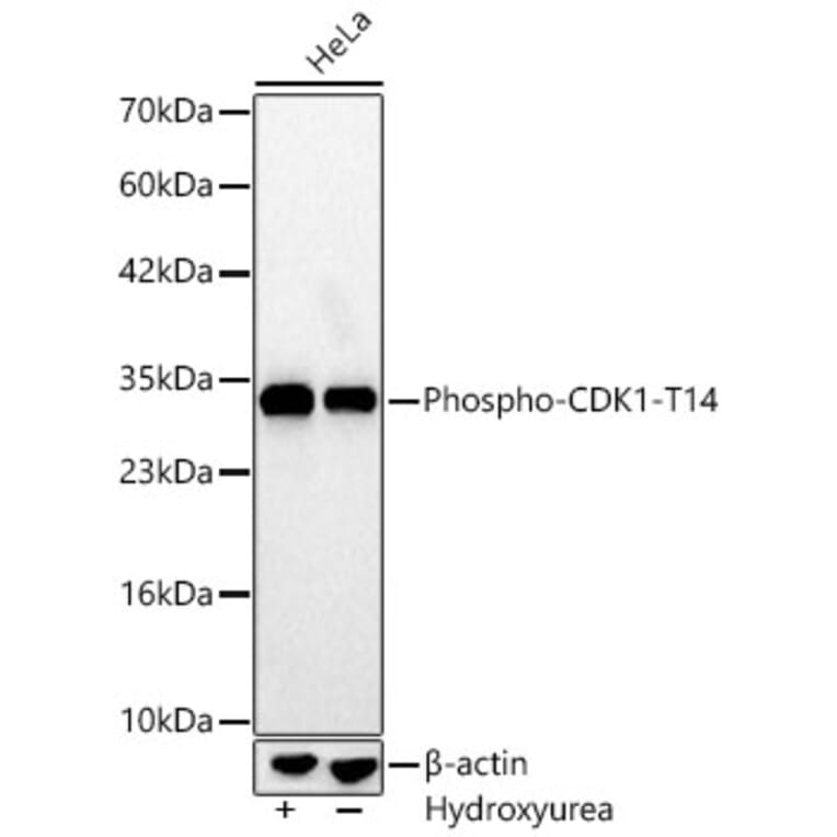 Western Blot - Anti-CDK1 (Phospho T14) Antibody [ARC66339] (A329246) - Antibodies.com