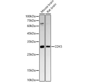 Western Blot - Anti-CDK5 Antibody [ARC53344] (A329247) - Antibodies.com