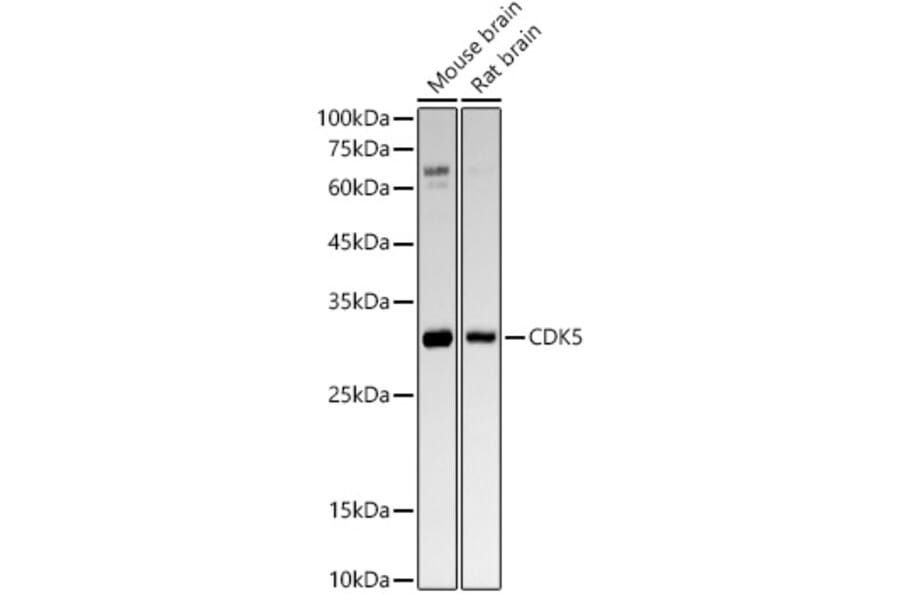 Western Blot - Anti-CDK5 Antibody [ARC53344] (A329247) - Antibodies.com