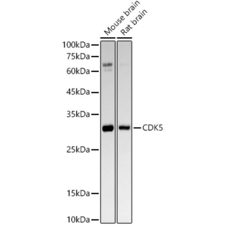 Western Blot - Anti-CDK5 Antibody [ARC53344] (A329247) - Antibodies.com