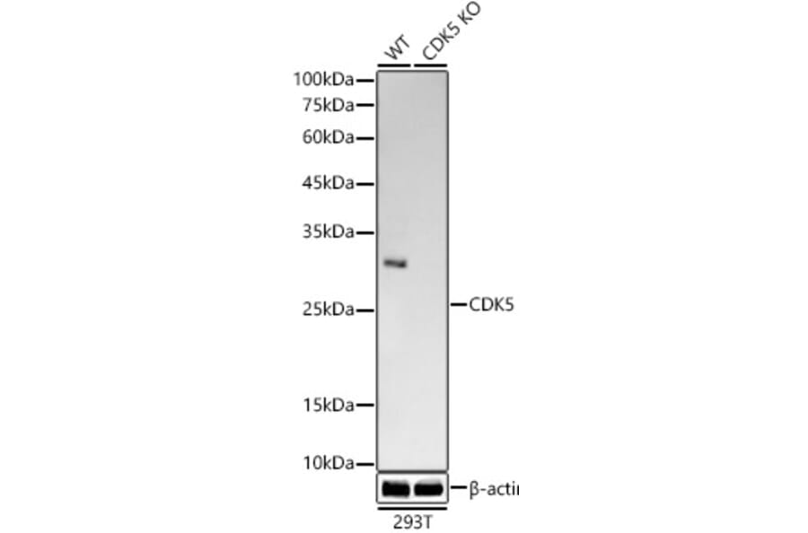 Western Blot - Anti-CDK5 Antibody [ARC53344] (A329247) - Antibodies.com