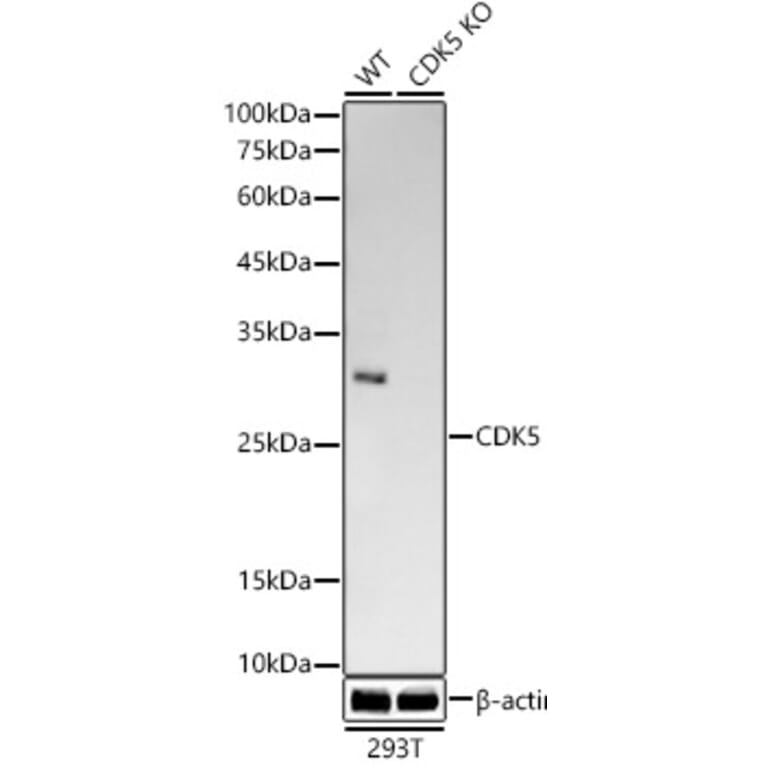 Western Blot - Anti-CDK5 Antibody [ARC53344] (A329247) - Antibodies.com
