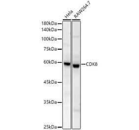 Western Blot - Anti-CDK8 Antibody [ARC59311] (A329248) - Antibodies.com