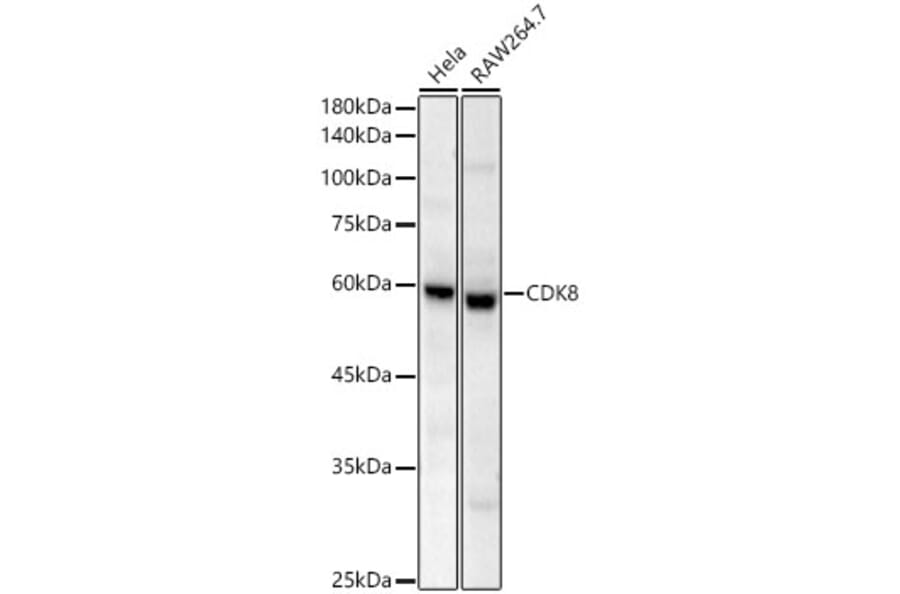 Western Blot - Anti-CDK8 Antibody [ARC59311] (A329248) - Antibodies.com