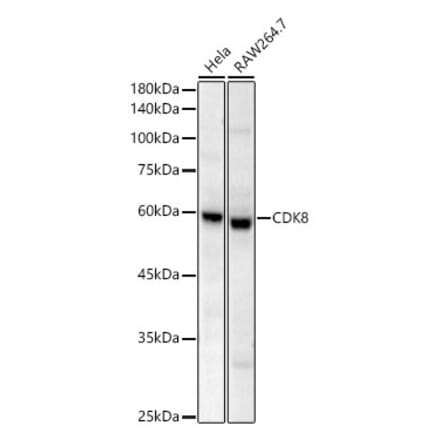 Western Blot - Anti-CDK8 Antibody [ARC59311] (A329248) - Antibodies.com