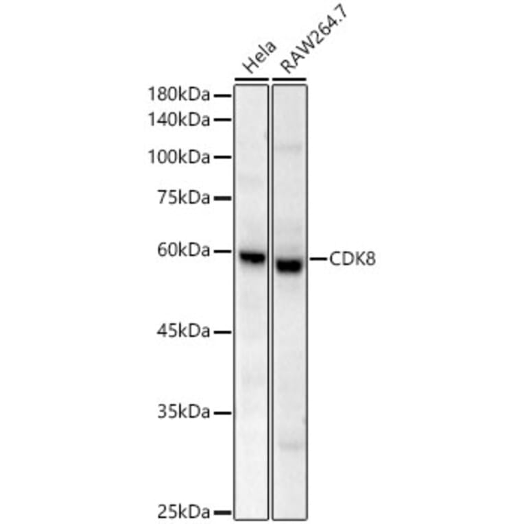 Western Blot - Anti-CDK8 Antibody [ARC59311] (A329248) - Antibodies.com