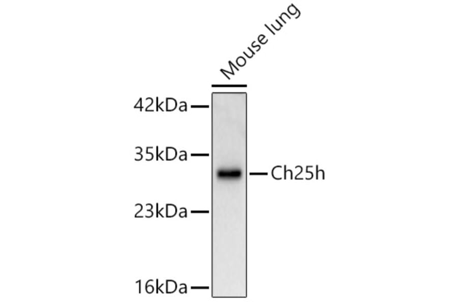 Western Blot - Anti-CH25H Antibody (A329254) - Antibodies.com